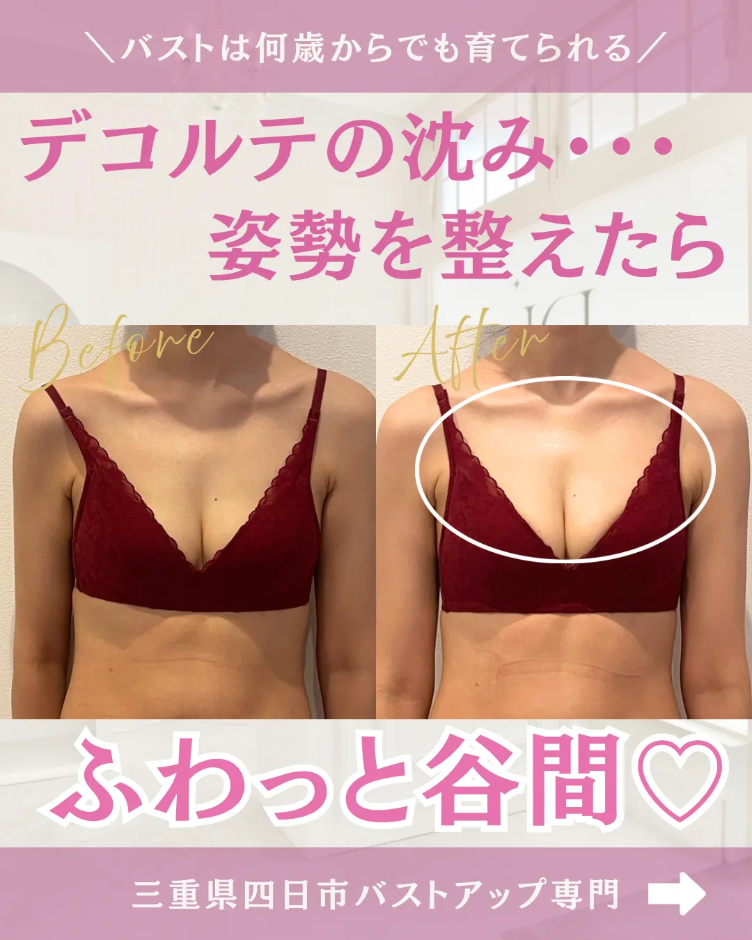 豊胸級バストアップ【BeforeAfter】三重県四日市市・育乳サロン